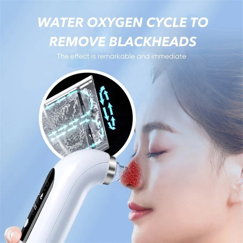 Vacuum Blackhead / Whitehead Remover